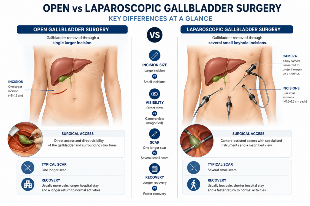 open vs keyhole gallbladder surgery