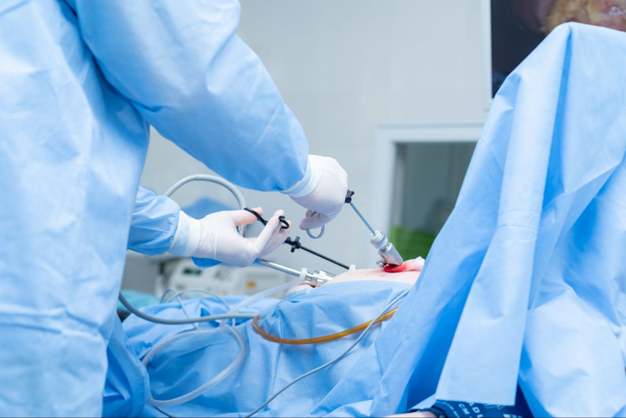 Laparoscopic gallbladder surgery procedure using keyhole incisions